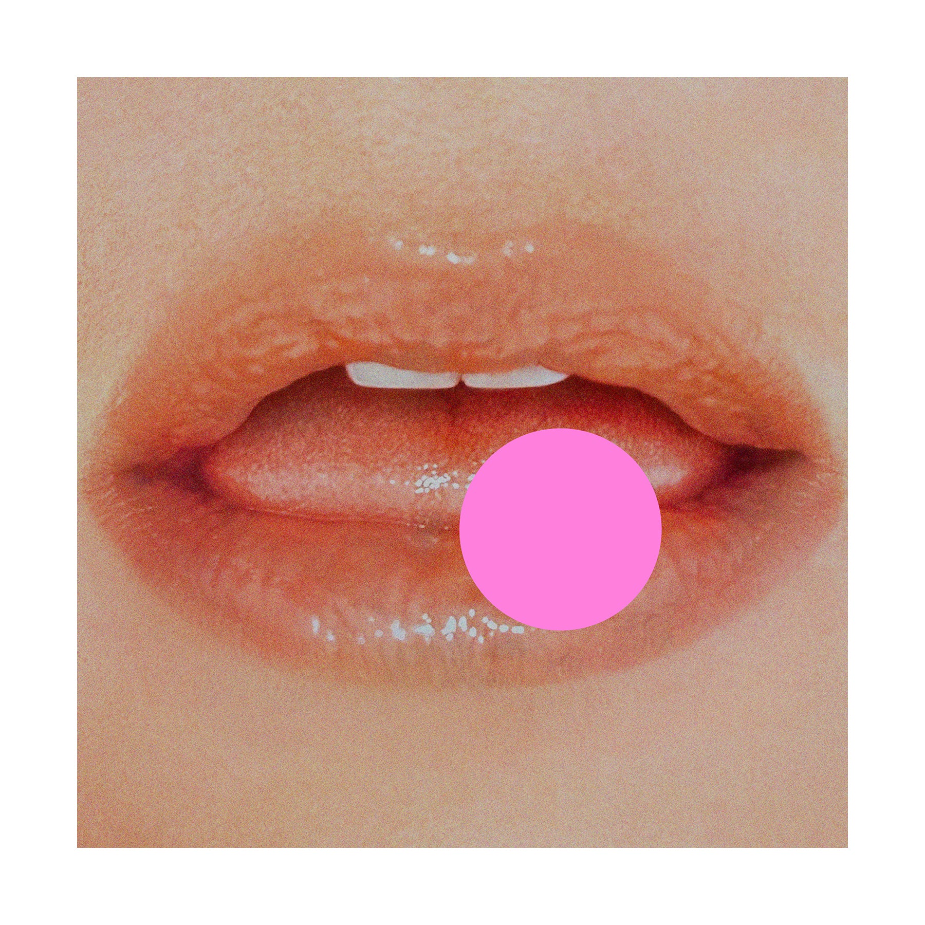 Music – Kesha